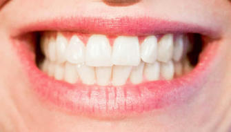 8 Surprising Tricks to Whiten Your Teeth at Home