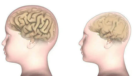 4 Facts about Brain Size Impacts People's Intelligence